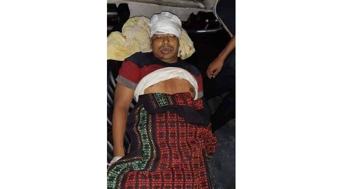 রামগড়ে দুর্বৃত্তদের হাতে সাবেক ছাত্রদল নেতা খুন