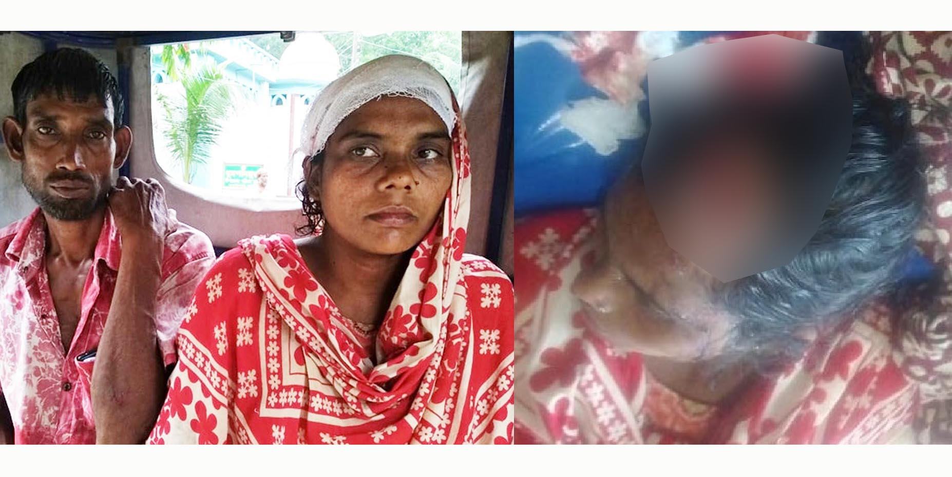 বাগাতিপাড়ায় স্বামীকে বাঁচাতে গিয়ে মাথা ফাটল স্ত্রীর