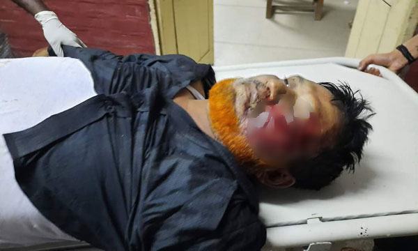 তাড়াশে সড়ক দুর্ঘটনায় মৎস্য কর্মকর্তা নিহত
