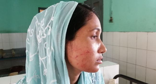 নাগরপুরে যৌতুকের দাবীতে অন্তঃসত্ত্বা গৃহবধূকে নির্যাতনের অভিযোগ