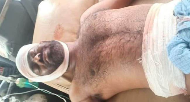 মিরসরাইয়ে ছাত্রলীগ নেতাকে কুপিয়ে জখম