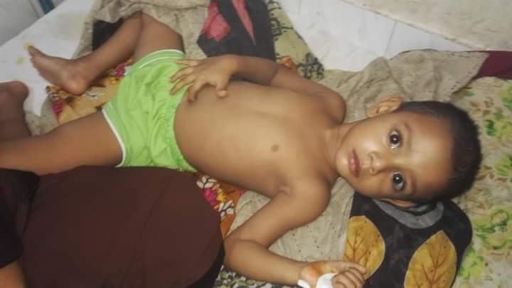নবজাতকের আকিকার মিষ্টি খেয়ে ১০ শিশু হাসপাতালে