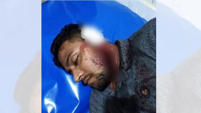 পুলিশ ফাঁড়ির অদূরে ২ ছাত্রলীগ নেতাকে কুপিয়ে জখম