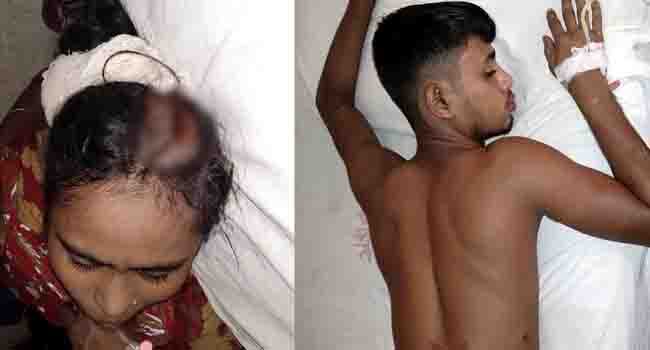 মঠবাড়িয়ায় নারীসহ তিনজনকে কুপিয়ে জখম