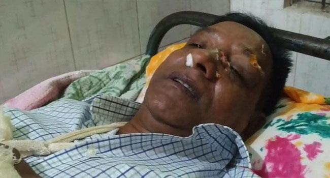 নীলফামারীতে আ’লীগ নেতার ওপর হামলা, সাবেক ভাইস-চেয়ারম্যান গ্রেফতার