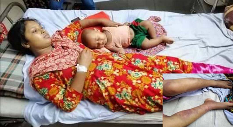 স্ত্রীকে গরম খুন্তির ছেঁকা