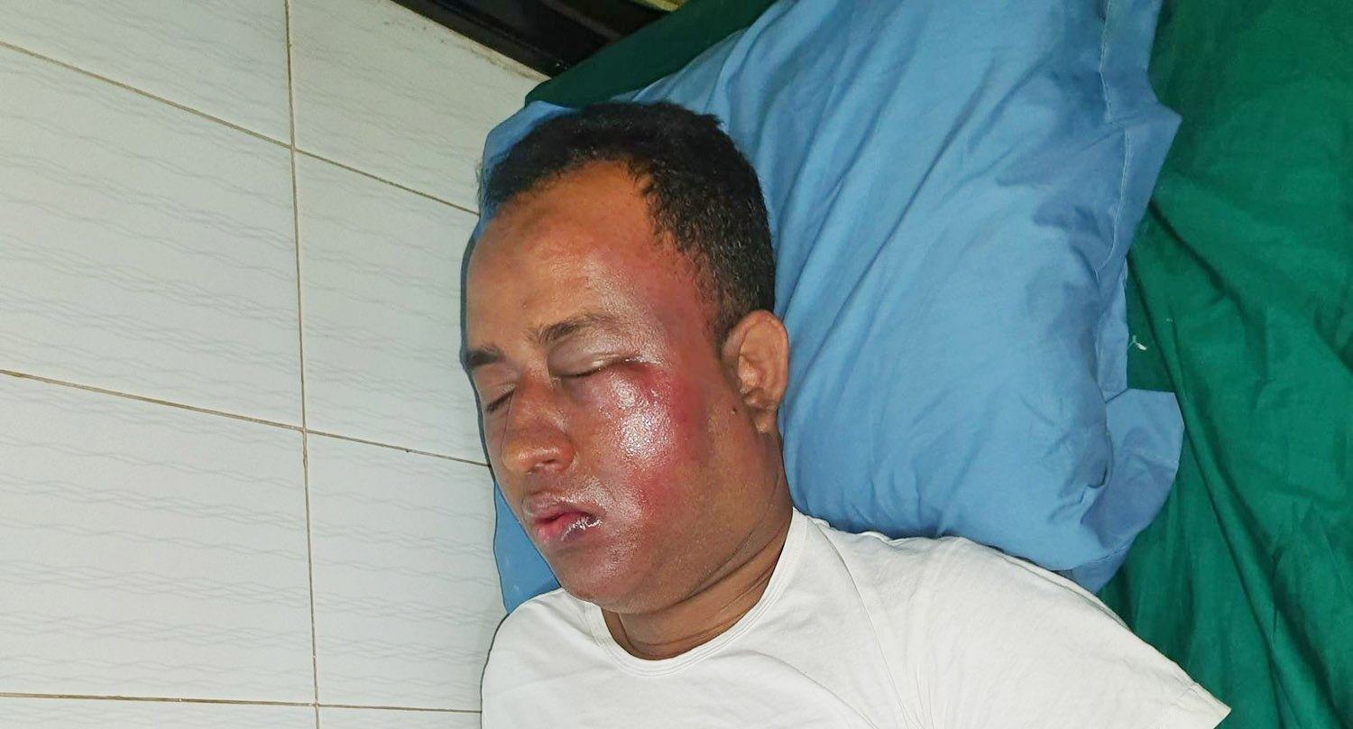 মিরসরাইয়ে ছিনতাকারীর কবলে ইবিএল ম্যানেজার