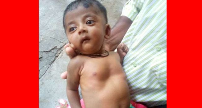 শিশু সামিয়াকে বাঁচাতে এগিয়ে আসুন