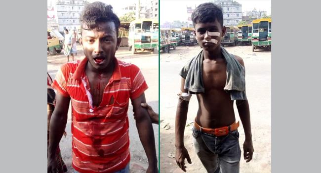 লালবাগে ইজিবাইক চালকদের হামলায় আহত ৭