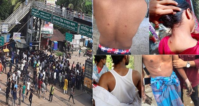মিরসরাইয়ে ছাত্রলীগের দু’গ্রুপে ধাওয়া পাল্টা ধাওয়া, নারী পথচারীসহ আহত ১০