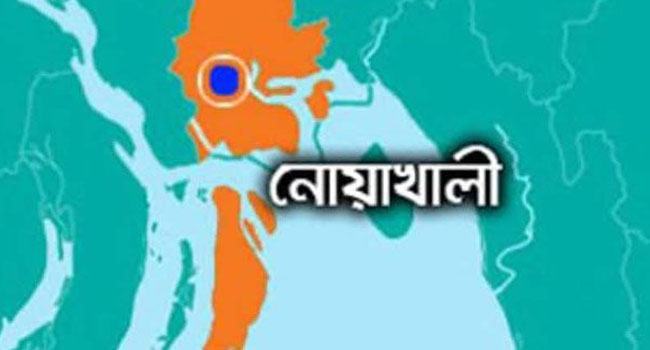 ছেলের দেয়া আগুনে সৎ মায়ের মৃত্যু