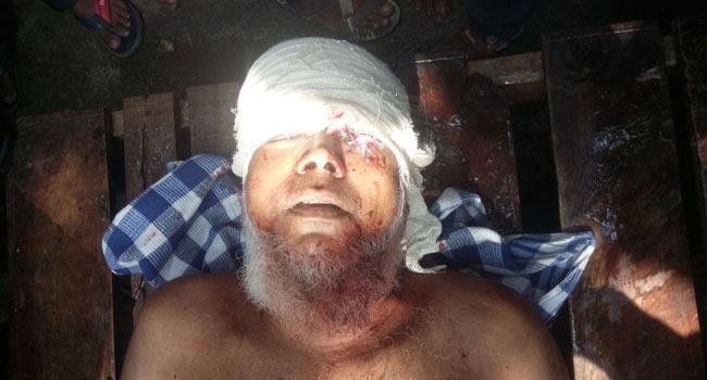 রুহিয়ায় সড়ক দুর্ঘটনায় মাদরাসা শিক্ষক নিহত