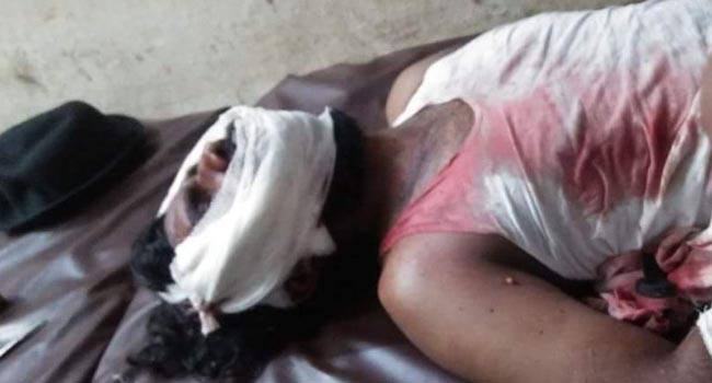 সাজেক ভ্রমণে গিয়ে বাস দুর্ঘটনায় ৩০ শিক্ষার্থী আহত