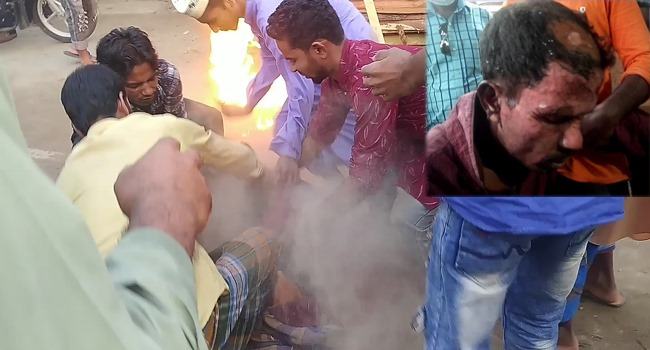 ফ্রান্সের প্রেসিডেন্টের কুশে আগুন দিতে গিয়ে দগ্ধ যুবক