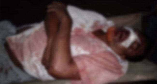 নোয়াখালীতে আ. লীগের দু'গ্রুপে সংঘর্ষে আহত ১১
