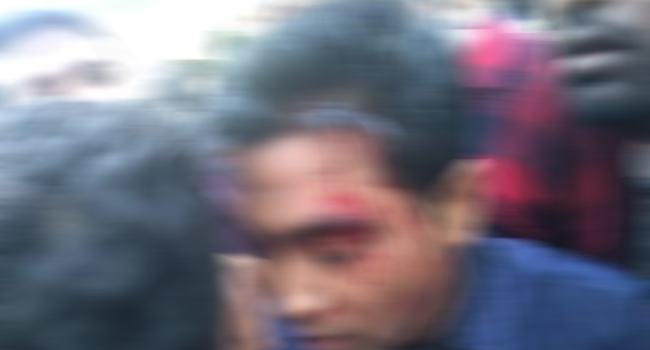 মিরসরাইয়ে যুবলীগের প্রতিষ্ঠা বার্ষিকীর সমাবেশে সংঘর্ষ, আহত ২০