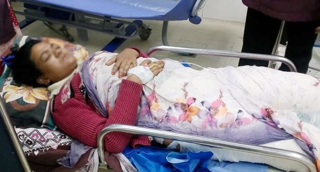 যৌতুক ও পরকীয়ায় স্ত্রীর গায়ে আগুন, পোড়া চামড়া টেনে তুলেছেন পাষণ্ড স্বামী!