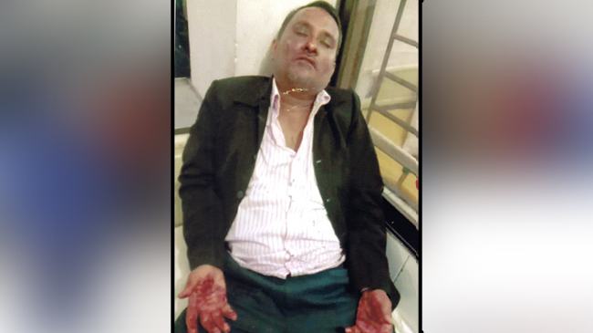 নোয়াখালীতে সন্ত্রাসী হামলায় নারীসহ ৩ জন গুরুতর আহত