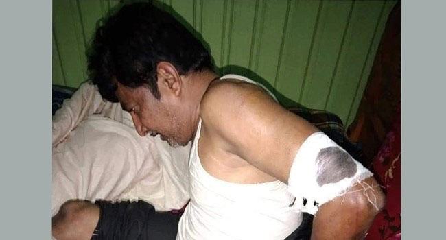 নোয়াখালীতে আ’লীগ নেতাকে কুপিয়ে জখম