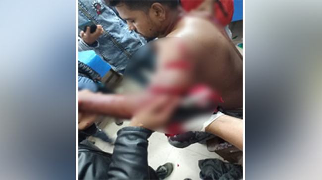 কলাপাড়ায় স্বতন্ত্রপ্রার্থীর কর্মীকে কুপিয়েছে নৌকা সমর্থকরা