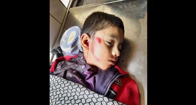 গাজীপুরে অটোরিকশার ধাক্কায় মাদরাসার শিশুছাত্র নিহত