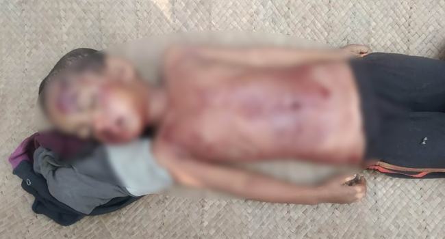 গাজীপুরে অটোরিকশার ধাক্কায় শিশু নিহত