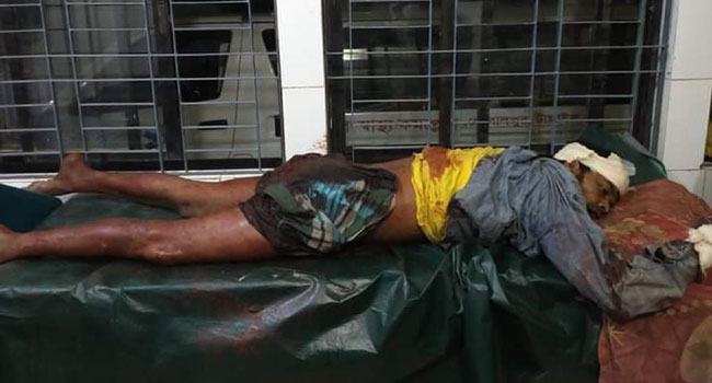 গোপালপুরে আওয়ামী লীগ ও বিদ্রোহী প্রার্থীর সমর্থকদের মধ্যে সংঘর্ষে নিহত ১