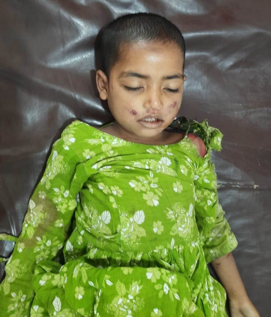 গাজীপুরে বেড়াতে এসে অটোরিকশার ধাক্কায় শিশু নিহত