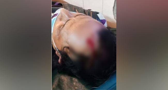 অনৈতিক মেলামেশায় নিষেধ করায় খুলনায় কলেজ শিক্ষককে পিটিয়ে আহত