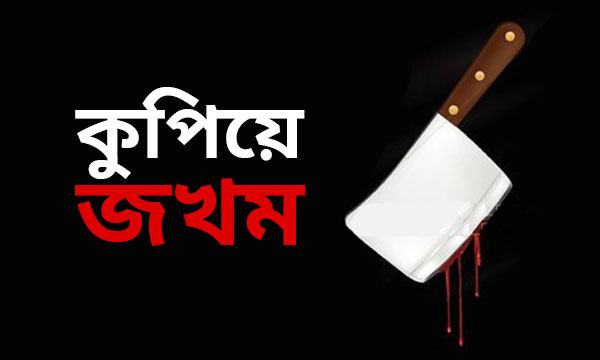 পুলিশের তাড়া খেয়ে বাদিকে কুপিয়ে আহত করল ধর্ষণ মামলার আসামি