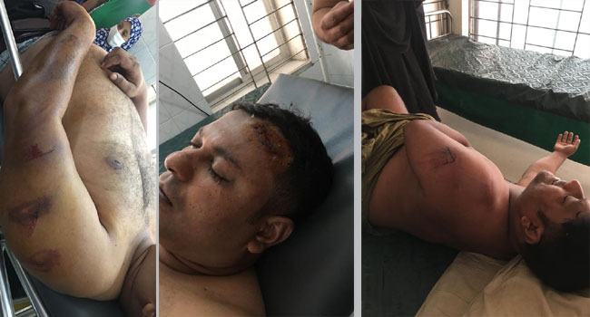 রাস্তা বন্ধ করে হামলা : গুরুতর জখম ২ যুবলীগ নেতা, সিসিটিভি ফুটেজ ভাইরাল