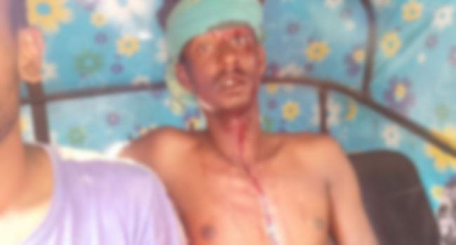 দিরাইয়ে দুই গ্রুপের সংঘর্ষে আহত ২০