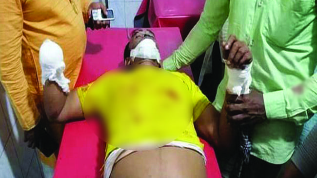 লালমোহনে স্বেচ্ছাসেবকলীগ নেতার হাতের কব্জি কেটে নিলো দুর্বৃত্তরা