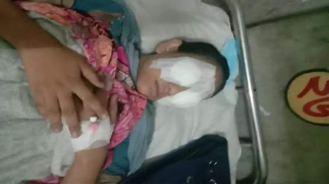 যৌতুকের দাবিতে গৃহবধূর চোখ উপড়ানোর চেষ্টা
