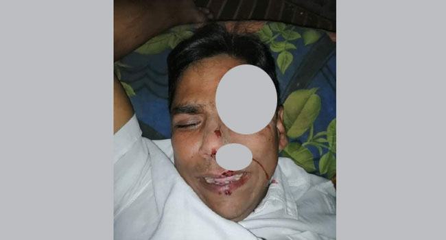 রূপগঞ্জের সেই কলির বিরুদ্ধে এবার ব্যবসায়ীকে মারধরের অভিযোগ