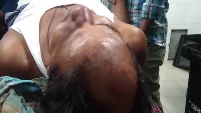 আমতলীতে ইউপি নির্বাচন : স্বতন্ত্রপ্রার্থীর ১০ কর্মীকে কুপিয়ে আহত