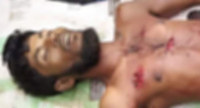 বরিশালে নির্বাচনী সংঘর্ষ : নিহত ১, আহত ১০