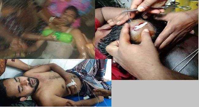 তাড়াশে প্রতিপক্ষের হামলায় ছাত্রলীগের সম্পাদকসহ আহত ৮, আটক ৩