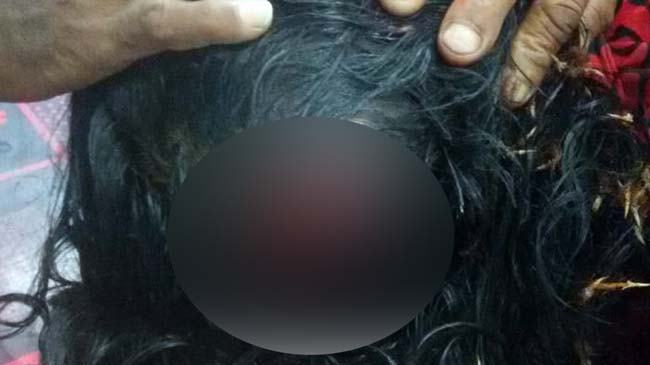 খোলা পায়খানা বন্ধ করতে বলায় সংঘর্ষ, ৮ নারী আহত
