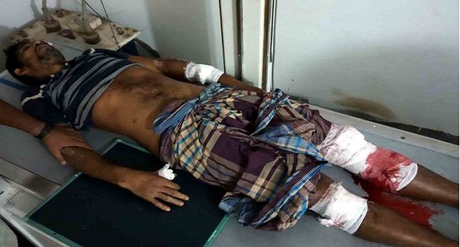 শরণখোলায় আ'লীগ নেতার হাত-পা ভেঙে দিয়েছে প্রতিপক্ষ