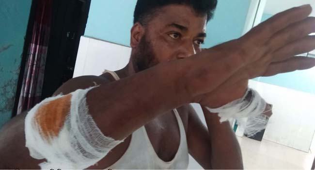 আমতলীতে সংঘর্ষে কাউন্সিলরসহ আহত ৪