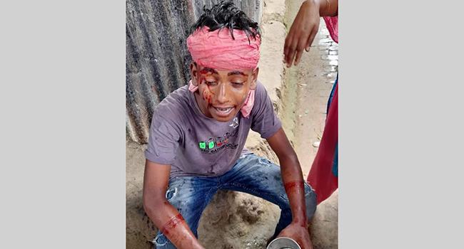 ছাত্রীর সাথে কথা বলা নিয়ে ২ পাড়ায় সংঘর্ষ, পুলিশসহ আহত ১৭
