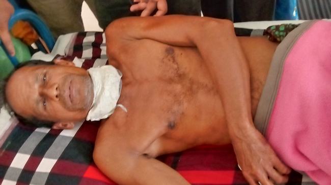 গোপালগঞ্জে পল্লী চিকিৎসককে গলা কেটে হত্যার চেষ্টা