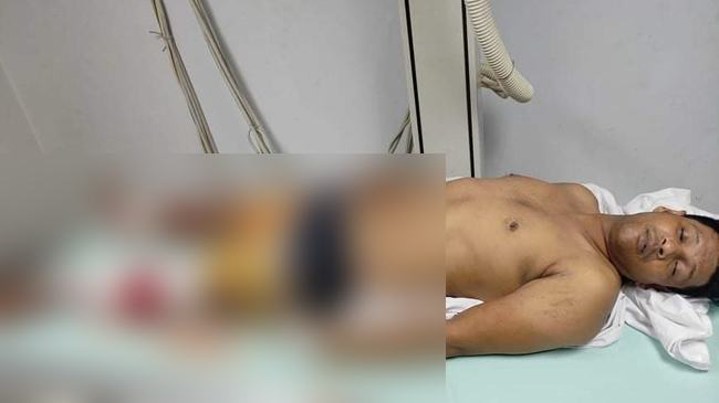 আশুলিয়ায় যুবলীগ নেতাকে কুপিয়ে হত্যা চেষ্টা