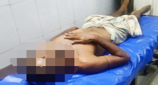 স্ত্রীর সাথে অভিমানে নিজের পুরুষাঙ্গ কাটলেন স্বামী
