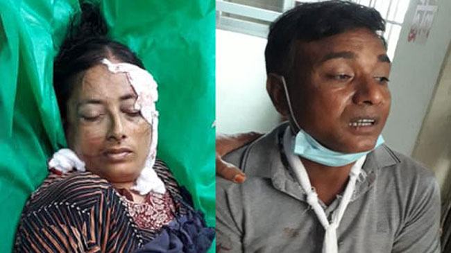 চৌগাছায় সড়ক দুর্ঘটনায় স্ত্রী নিহত, গুরুতর আহত স্বামী