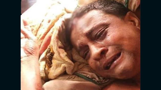 কোম্পানীগঞ্জে এবার ঘরে ঢুকে সাংবাদিককে কুপিয়ে জখম