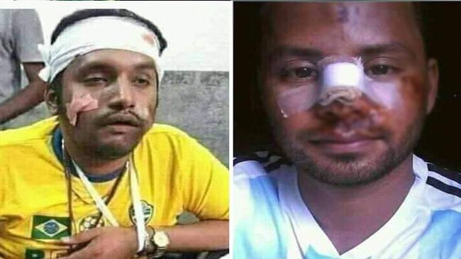 ব্রাহ্মণবাড়িয়ায় ব্রাজিল-আর্জেন্টিনা সমর্থকদের পাল্টাপাল্টি হামলা, আহত ৪