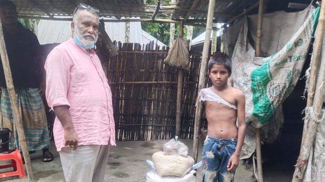 খাদ্র্য সামগ্রী পেলেন হাত হারানো চয়ন