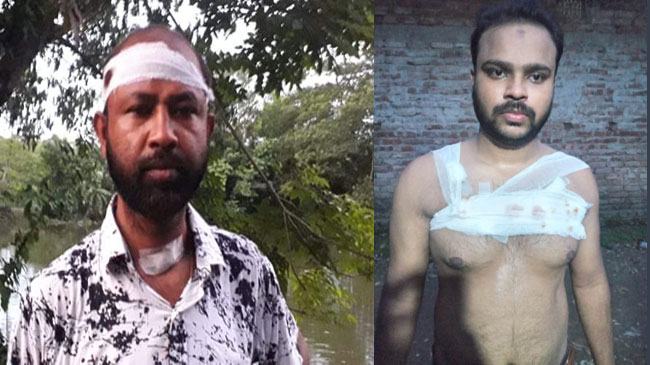 কোম্পানীগঞ্জে ভাইস চেয়ারম্যানের বাড়িতে ককটেল-গুলি নিক্ষেপের অভিযোগ, গুলিবিদ্ধ ৩